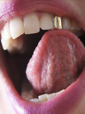 Gold Grillz Mouth Teeth, single