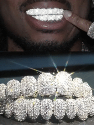 Gold Teeth 14k Baguette Joker