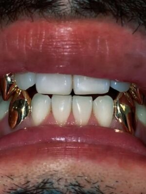 Gold Grillz teeth Unisex  Fangs Set  OF 4