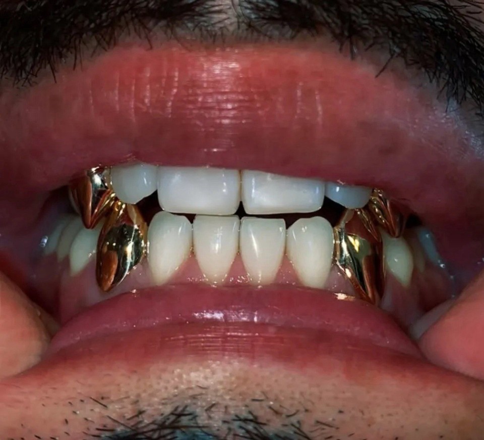 Gold Grillz teeth Unisex  Fangs Set  OF 4